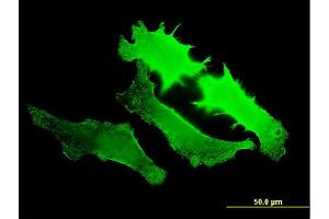 Immunofluorescence of monoclonal antibody to GUCY2D on HeLa cell. (GUCY2D Antikörper  (AA 521-630))