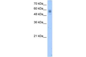 Western Blotting (WB) image for anti-Vitamin K-dependent protein C (PROC) antibody (ABIN2462458) (PROC Antikörper)