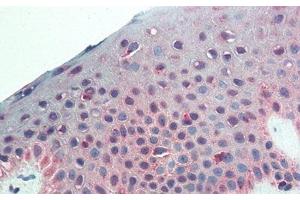 Detection of CSPG4 in Human Skin Tissue using Monoclonal Antibody to Chondroitin Sulfate Proteoglycan 4 (CSPG4) (NG2 Antikörper  (AA 559-776))