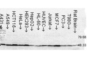 Western Blot analysis of Human Cell lysates showing detection of FKBP52 protein using Mouse Anti-FKBP52 Monoclonal Antibody, Clone Hi52C . (FKBP4 Antikörper  (Atto 594))