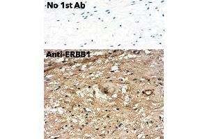 Immunohistochemistry (IHC) image for anti-Epidermal Growth Factor Receptor (EGFR) (C-Term) antibody (ABIN6254171) (EGFR Antikörper  (C-Term))