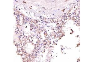 IHC analysis of Acid Phosphatase/ACP5 using anti-Acid Phosphatase/ACP5 antibody (ABIN7601574). (ACP5 Antikörper  (AA 39-325))