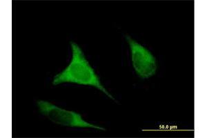 Immunofluorescence of purified MaxPab antibody to EIF2B3 on HeLa cell. (EIF2B3 Antikörper  (AA 1-452))