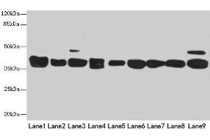 Western blot All lanes: DNAJB1 antibody at 3 μg/mL Lane 1: Mouse spleen tissue Lane 2: Colo320 whole cell lysate Lane 3: Hela whole cell lysate Lane 4: LO2 whole cell lysate Lane 5: HepG2 whole cell lysate Lane 6: HT29 whole cell lysate Lane 7: A549 whole cell lysate Lane 8: Jurkat whole cell lysate Lane 9: MCF-7 whole cell lysate Secondary Goat polyclonal to rabbit IgG at 1/10000 dilution Predicted band size: 39, 28 kDa Observed band size: 39 kDa (DNAJB1 Antikörper  (AA 1-340))
