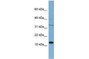 WB Suggested Anti-PHLDA2  Antibody Titration: 0.