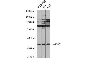 Western blot analysis of extracts of various cell lines, using GNT antibody  at 1:1000 dilution. (A4GNT Antikörper  (AA 1-340))