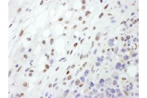 anti-Lamin A/C (LMNA) (AA 400-450) antibody