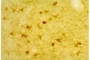 Low magnification IHC image of neurons in rat cortex. (HTR2A Antikörper  (AA 22-41))