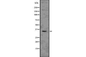 Western blot analysis of TMX2 using K562 whole  lysates. (TMX2 Antikörper  (N-Term))