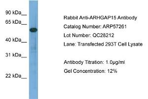 WB Suggested Anti-ARHGAP15  Antibody Titration: 0. (ARHGAP15 Antikörper  (Middle Region))