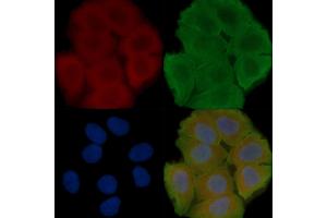 ABIN6258145 and ABIN6273917 staining Hela cells(30 min of UV treatment) by IF/ICC. (S1PR5 Antikörper  (C-Term))