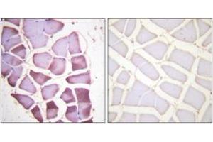 Immunohistochemistry analysis of paraffin-embedded human skeletal muscle, using S6 Ribosomal Protein (Phospho-Ser240) Antibody. (RPS6 Antikörper  (pSer240))