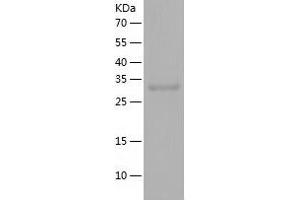 Western Blotting (WB) image for Ubiquitin-Like Domain Containing CTD Phosphatase 1 (UBLCP1) (AA 1-318) protein (His tag) (ABIN7288111) (UBLCP1 Protein (AA 1-318) (His tag))