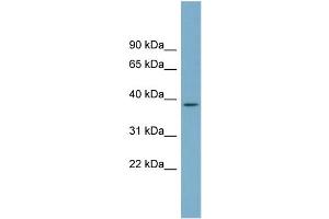 WB Suggested Anti-SDSL Antibody Titration:  0. (SDSL Antikörper  (N-Term))