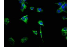 Immunofluorescence staining of HepG2 cells with ABIN7154406 at 1:466, counter-stained with DAPI. (CSF2RA Antikörper  (AA 23-320))