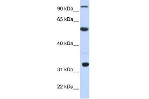 WB Suggested Anti-APOBEC1 Antibody Titration:  0. (APOBEC1 Antikörper  (N-Term))