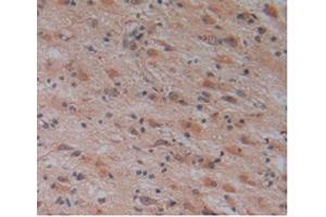 Immunohistochemistry (IHC) image for anti-Corin, Serine Peptidase (CORIN) (AA 134-573) antibody (ABIN7442108)