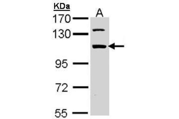 RBM28 Antikörper  (C-Term)