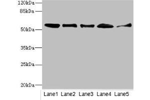 Western blot All lanes: GLYCTKantibody at 5. (GLYCTK Antikörper  (AA 284-523))