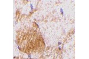 Immunohistochemistry of IL-31 in rat skeletal muscle tissue with IL-31 antibody at 10 μg/ml.