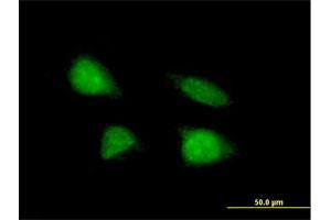 Immunofluorescence of purified MaxPab antibody to C19orf43 on HeLa cell. (C19orf43 Antikörper  (AA 1-176))