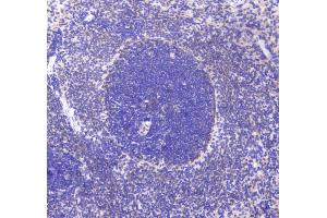 IHC analysis of CD80 using anti-CD80 antibody . (CD80 Antikörper  (AA 35-244))