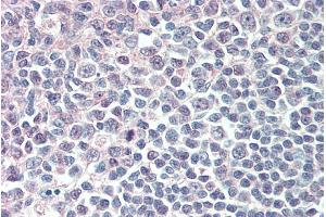 Image no. 2 for anti-Interferon Regulatory Factor 8 (IRF8) antibody (ABIN5868811) (IRF8 Antikörper)