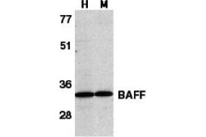 Western Blotting (WB) image for anti-Tumor Necrosis Factor (Ligand) Superfamily, Member 13b (TNFSF13B) (C-Term) antibody (ABIN1030279)