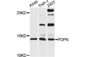 Western blot analysis of extracts of various cell lines, using PDPN antibody (ABIN5974310) at 1/1000 dilution. (Podoplanin Antikörper)