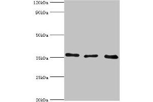 Western blot All lanes: Annexin A4 antibody at 4 μg/mL Lane 1: 293T whole cell lysate Lane 2: Hela whole cell lysate Lane 3: HepG2 whole cell lysate Secondary Goat polyclonal to rabbit IgG at 1/10000 dilution Predicted band size: 36, 28 kDa Observed band size: 36 kDa