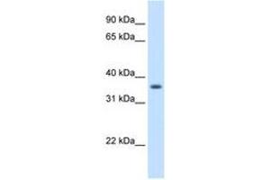 Image no. 1 for anti-Aldo-Keto Reductase Family 1, Member B10 (Aldose Reductase) (AKR1B10) (AA 51-100) antibody (ABIN204999)
