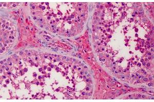 Human Testis, Leydig Cells: Formalin-Fixed, Paraffin-Embedded (FFPE) (APOA2 Antikörper)