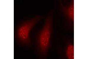 Immunofluorescence staining of methanol-fixed Hela cells using p90RSK(Phospho-Thr348) Antibody. (RPS6KA1 Antikörper  (pThr348))