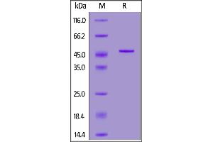 HCoV-NL63 Nucleocapsid (AA 1-377) protein (His tag)