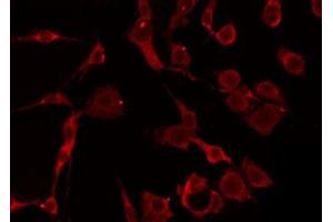 ABIN6274797 staining HepG2 by IF/ICC. (ACAT1 Antikörper  (Internal Region))