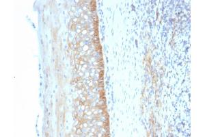 Formalin-fixed, paraffin-embedded human Tonsil stained with CD73 Mouse Monoclonal Antibody (NT5E/2545). (CD73 Antikörper)