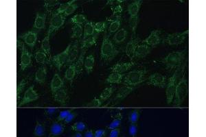 Immunofluorescence analysis of C6 cells using AEBP1 Polyclonal Antibody at dilution of 1:100 (40x lens). (AEBP1 Antikörper)