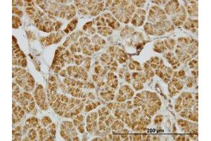 Image no. 1 for anti-Centromere Protein J (CENPJ) (AA 979-1089) antibody (ABIN599271) (CENPJ Antikörper  (AA 979-1089))