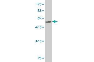 Western Blot detection against Immunogen (59. (MEOX2 Antikörper  (AA 1-303))