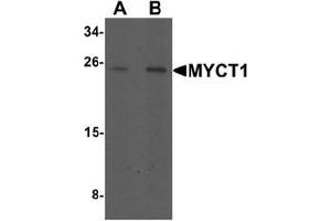 Western blot analysis of MYCT1 in rat lung tissue lysate with MYCT1 antibody at (A) 1 and (B) 2 ug/mL. (Myc Target 1 Antikörper  (C-Term))