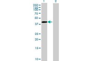 Western Blot analysis of ZNF485 expression in transfected 293T cell line by ZNF485 MaxPab polyclonal antibody.