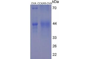 Cholecystokinin A Receptor (CCKAR) (AA 398-412) peptide (Ovalbumin)