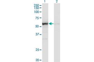 Western Blot analysis of OXSR1 expression in transfected 293T cell line by OXSR1 monoclonal antibody (M14), clone 1B10. (OXSR1 Antikörper  (AA 1-527))