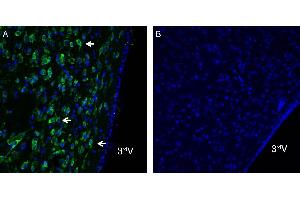 Immunohistochemistry (IHC) image for anti-ORAI Calcium Release-Activated Calcium Modulator 1 (ORAI1) (AA 200-212), (Extracellular) antibody (ABIN7043408)
