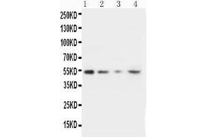 Lane 4: HELA Cell Lysate (MMP10 Antikörper  (C-Term))