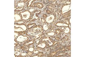 IHC analysis of TST using anti-TST antibody (ABIN7599105).