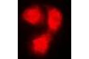 Immunofluorescent analysis of Beta 2 Microglobulin staining in Hela cells.