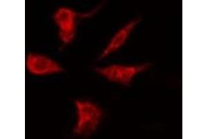 ABIN6275226 staining Hela by IF/ICC. (PGRMC2 Antikörper  (C-Term))