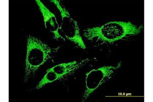 Immunofluorescence of monoclonal antibody to PRDX3 on HeLa cell.