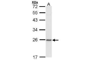 WB Image Sample (30 ug of whole cell lysate) A: Raji 12% SDS PAGE antibody diluted at 1:1000 (CBX1 Antikörper  (Center))